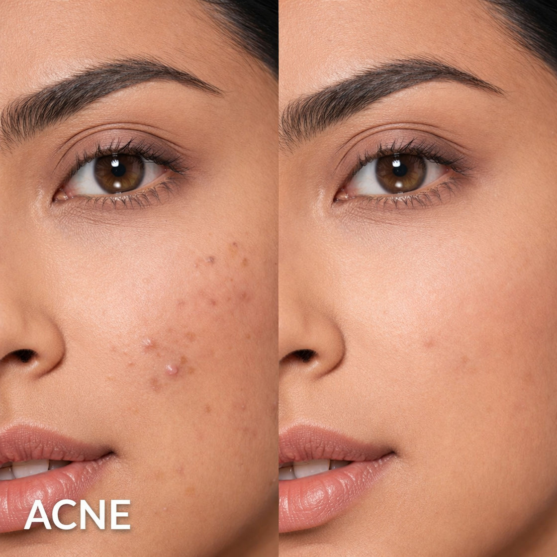 Stick Foundation